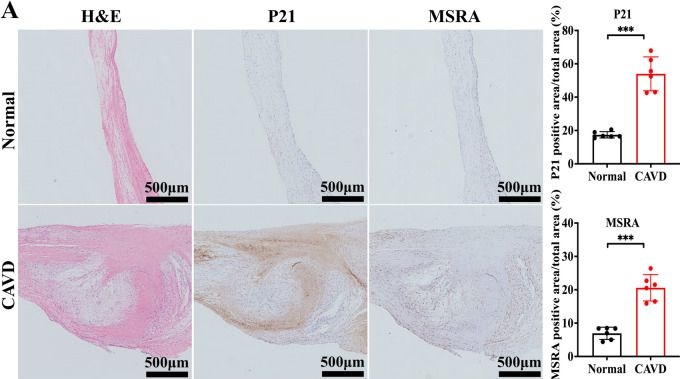 Fig.2.A showing Immunohistochemistry from the publication: Age-associated methionine sulfoxide reductase A protects against valvular interstitial cell senescence and valvular calcification.