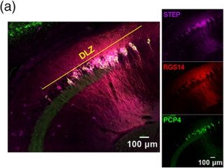Fig.9.A showing Immunohistochemistry-immunofluorescence in a Mus musculus (House mouse) sample from the publication: Morphological and molecular markers of mouse area CA2 along the proximodistal and dorsoventral hippocampal axes.
