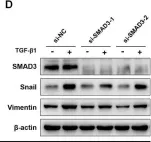 Fig.4.D showing Western Blotting from the publication: MiR-135-5p inhibits TGF-β-induced epithelial-mesenchymal transition and metastasis by targeting SMAD3 in breast cancer.