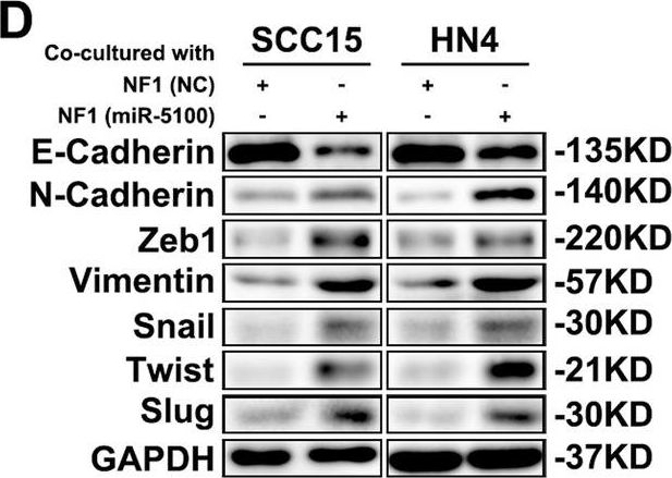 Fig.5.D showing Western Blotting from the publication: Hypoxia-induced miR-5100 promotes exosome-mediated activation of cancer-associated fibroblasts and metastasis of head and neck squamous cell carcinoma.
