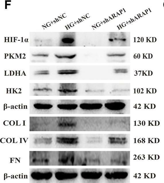 Fig.4.F showing Western Blotting in a Homo sapiens (Human) sample from the publication: YY1-induced upregulation of LncRNA-ARAP1-AS2 and ARAP1 promotes diabetic kidney fibrosis via aberrant glycolysis associated with EGFR/PKM2/HIF-1α pathway.