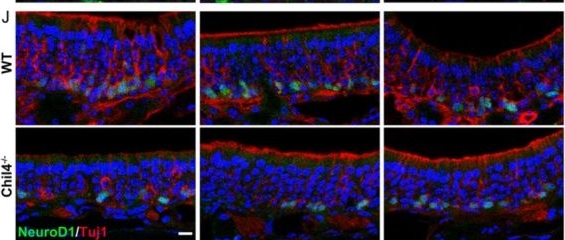 Fig.2.J showing Immunohistochemistry-immunofluorescence in a Mus musculus (House mouse) sample from the publication: Deficiency of Aging-Related Gene Chitinase-Like 4 Impairs Olfactory Epithelium Homeostasis.