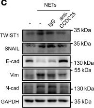 Fig.7.C showing Western Blotting from the publication: Tumor-derived neutrophil extracellular trap-associated DNA impairs treatment efficacy in breast cancer via CCDC25-dependent epithelial-mesenchymal transition.