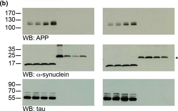 Fig.4.B showing Western Blotting in a Mus musculus (House mouse) sample from the publication: SUMO1-conjugation is altered during normal aging but not by increased amyloid burden.