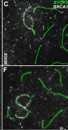 Fig.7.C showing Immunohistochemistry-immunofluorescence in a Meleagris gallopavo (Turkey) sample from the publication: Heterogeneity in conservation of multifunctional partner enzymes with meiotic importance, CDK2 kinase and BRCA1 ubiquitin ligase.