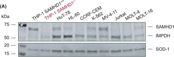 Fig.5.A showing Western Blotting in a Homo sapiens (Human) sample from the publication: IMPDH inhibition enhances cytarabine efficacy in SAMHD1-expressing leukaemia cells via guanine nucleotide depletion.