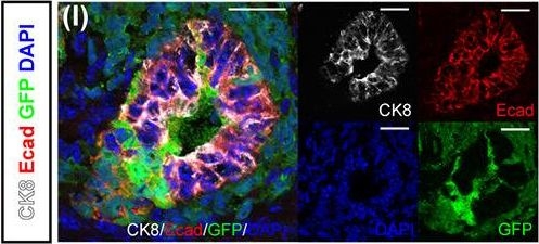 Beneficial Impact of Interspecies Chimeric Renal Organoids Against a Xenogeneic Immune Response.