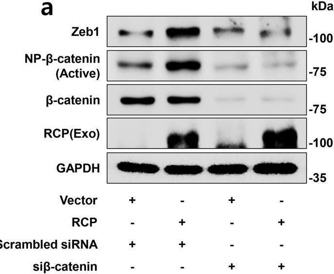 Fig.4.A showing Western Blotting in a Homo sapiens (Human) sample from the publication: Zeb1 for RCP-induced oral cancer cell invasion and its suppression by resveratrol.