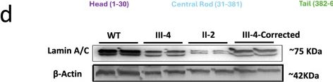 Fig.2.D showing Western Blotting in a Homo sapiens (Human) sample from the publication: Gene-gene interactions between a LMNA variant and common polymorphisms drive early-onset atrial fibrillation.