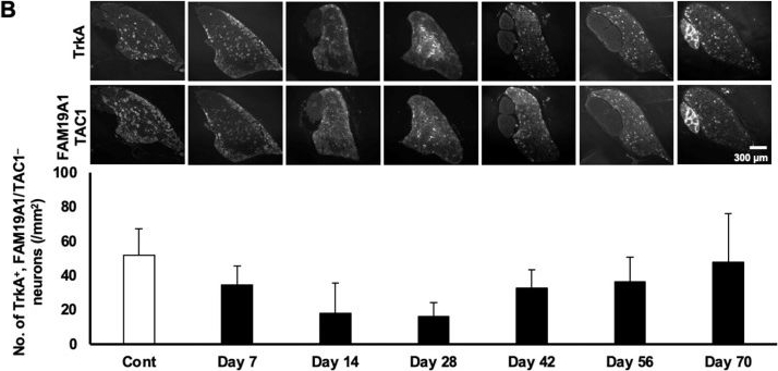 Fig.3.B showing Immunocytochemistry-immunofluorescence in a Rattus norvegicus (Rat) sample from the publication: The Reversible Neurotoxic Effects of Methylmercury on the Dorsal Root Ganglion: Temporal Dynamics in Rats.