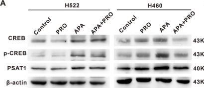 Fig.5.A showing Western Blotting from the publication: Targeting ADRB2 enhances sensitivity of non-small cell lung cancer to VEGFR2 tyrosine kinase inhibitors.