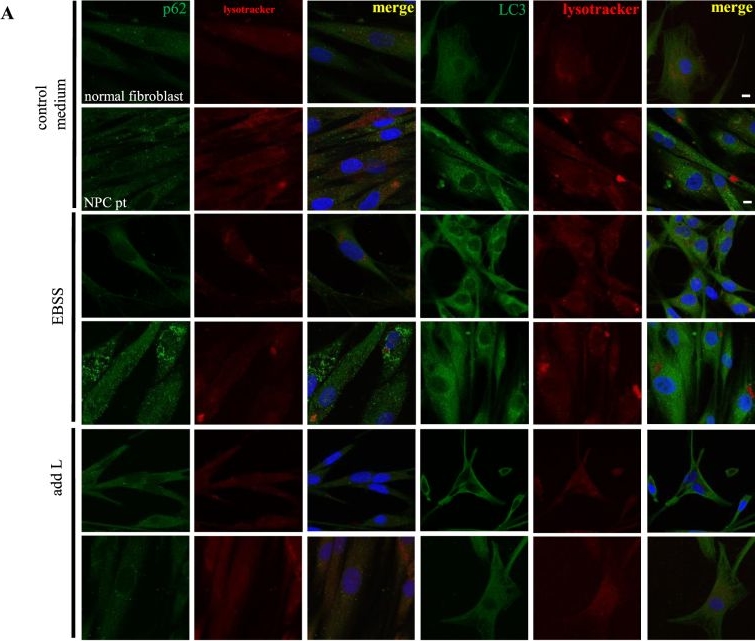 L-leucine and SPNS1 coordinately ameliorate dysfunction of autophagy in mouse and human Niemann-Pick type C disease.