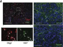 Fig.2.D showing Immunocytochemistry-immunofluorescence in a Mus musculus (House mouse) sample from the publication: Somatic chromosomal engineering identifies BCAN-NTRK1 as a potent glioma driver and therapeutic target.