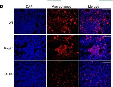 Fig.6.D from the publication: Recruitment of CXCR4+ type 1 innate lymphoid cells distinguishes sarcoidosis from other skin granulomatous diseases.