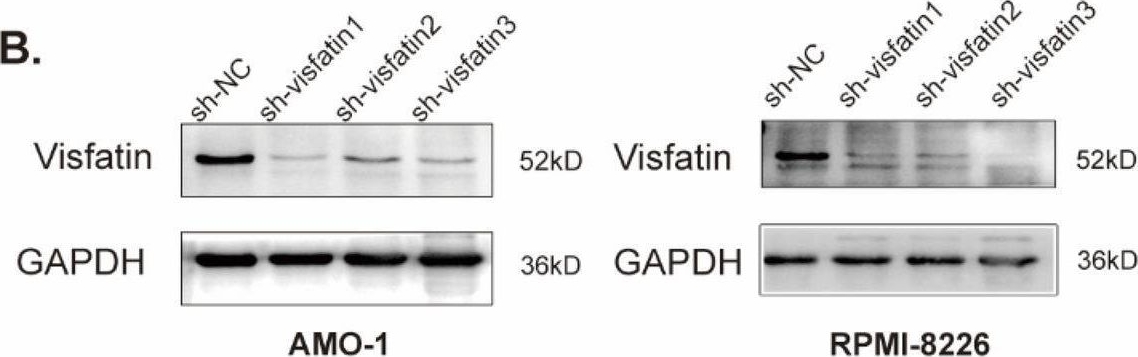 Fig.4.B showing Western Blotting in a Homo sapiens (Human) sample from the publication: Visfatin promotes multiple myeloma cell proliferation and inhibits apoptosis by inducing IL-6 production via NF-κB pathways.
