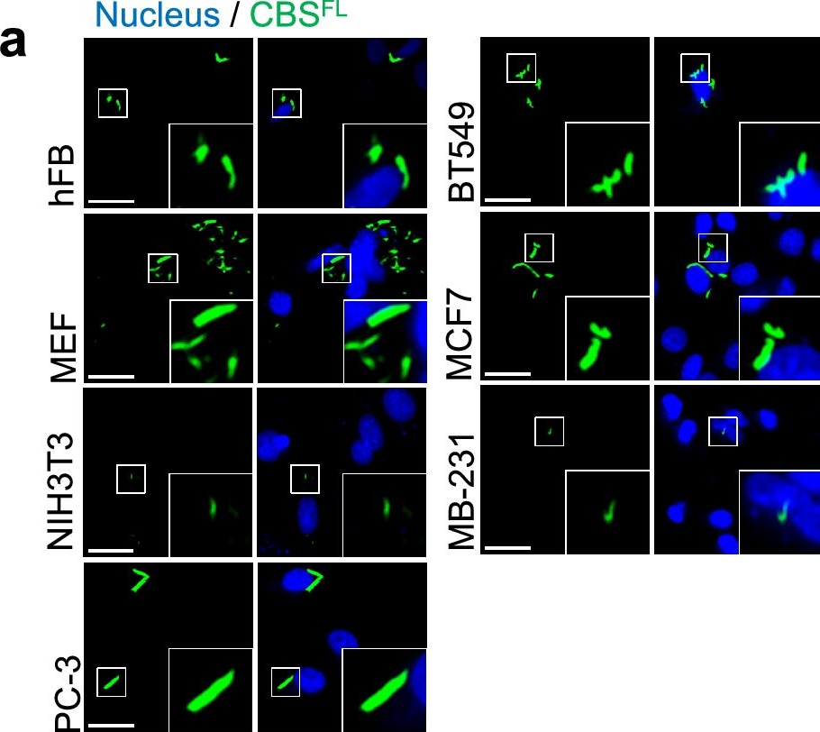 Fig.5.A showing Immunocytochemistry-immunofluorescence from the publication: Architecture and regulation of filamentous human cystathionine beta-synthase.