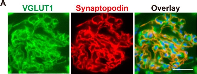 anti-Synaptopodin/SYNPO mouse monoclonal, G1D4, supernatant | 5 ml