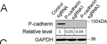 Fig.4.A showing Western Blotting from the publication: P-Cadherin Regulates Intestinal Epithelial Cell Migration and Mucosal Repair, but Is Dispensable for Colitis Associated Colon Cancer.