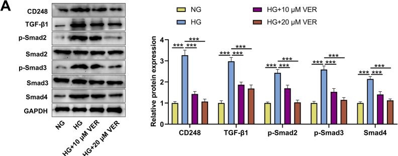 Fig.7.A showing Western Blotting from the publication: CD248, targeted by veratramine and neobavaisoflavone, mediates pathological changes of renal tubular epithelial cells induced by high glucose.