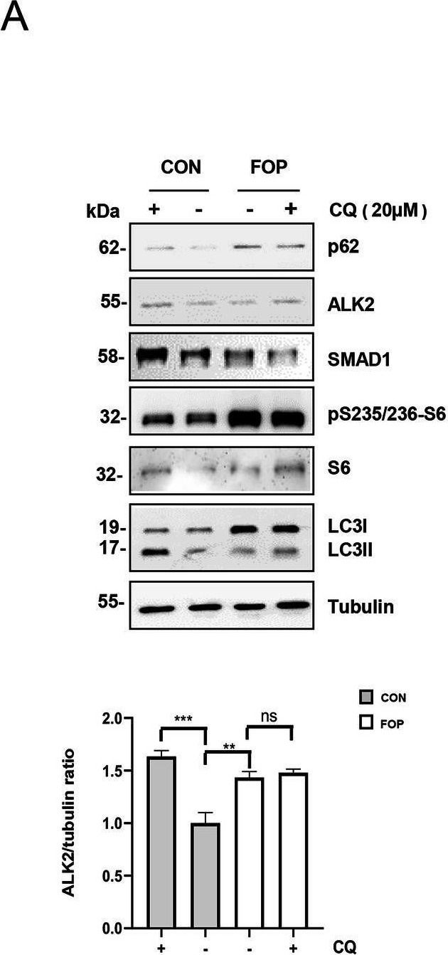 Fig.5.A showing Western Blotting in a Homo sapiens (Human) sample from the publication: Interplay between ALK2R206H mutant receptor and autophagy signaling regulates receptor stability and its chondrogenic functions.