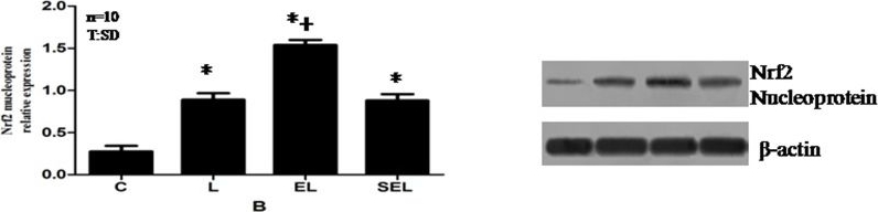 Fig.3.B showing Western Blotting in an Oryctolagus cuniculus (Rabbit) sample from the publication: Role of Nrf2/ARE pathway in protective effect of electroacupuncture against endotoxic shock-induced acute lung injury in rabbits.