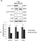 Fig.6.B showing Western Blotting from the publication: Phosphorylation of RCC1 on Serine 11 Facilitates G1/S Transition in HPV E7-Expressing Cells.