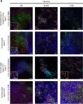 Fig.3.A showing Immunocytochemistry-immunofluorescence in a Homo sapiens (Human) sample from the publication: Analysing human neural stem cell ontogeny by consecutive isolation of Notch active neural progenitors.