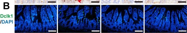 Fig.7.B showing Immunohistochemistry-immunofluorescence from the publication: Excretory/secretory products from Hymenolepis nana adult worms alleviate ulcerative colitis in mice via tuft/IL-13 signaling pathway.