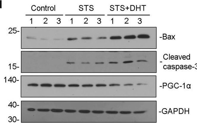 Fig.8.I showing Western Blotting from the publication: Sirtuin 6 is a key contributor to gender differences in acute kidney injury.