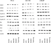 Fig.2.A showing Western Blotting in a Homo sapiens (Human) sample from the publication: Molecular targeting of prostate cancer cells by a triple drug combination down-regulates integrin driven adhesion processes, delays cell cycle progression and interferes with the cdk-cyclin axis.