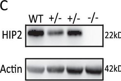 Fig.1.C showing Western Blotting from the publication: Reduction of HIP2 expression causes motor function impairment and increased vulnerability to dopaminergic degeneration in Parkinson's disease models.
