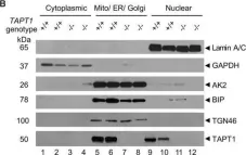 Fig.5.B showing Western Blotting from the publication: A progeroid syndrome caused by a deep intronic variant in TAPT1 is revealed by RNA/SI-NET sequencing.