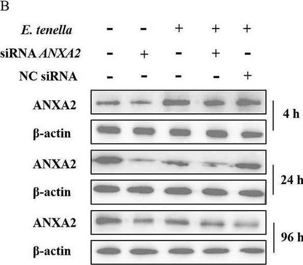 Fig.1.B showing Western Blotting in a Gallus gallus domesticus (Chicken) sample from the publication: Knockdown of annexin A2 enhances the host cell apoptosis induced by Eimeria tenella.