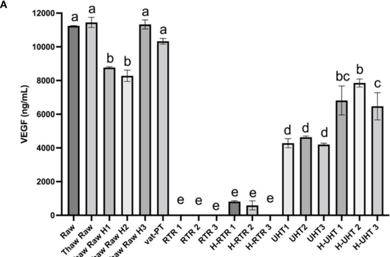 Fig.5.A showing Enzyme-linked immunosorbent assay from the publication: Structural and functional changes of bioactive proteins in donor human milk treated by vat-pasteurization, retort sterilization, ultra-high-temperature sterilization, freeze-thawing and homogenization.