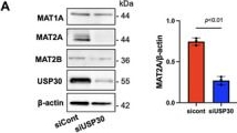Fig.5.A showing Western Blotting from the publication: Activation of USP30 Disrupts Endothelial Cell Function and Aggravates Acute Lung Injury Through Regulating the S-Adenosylmethionine Cycle.