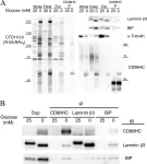 Fig.4.A,B showing Western Blotting in a Homo sapiens (Human) sample from the publication: Study of global transcriptional changes of N-GlcNAc2 proteins-producing T24 bladder carcinoma cells under glucose deprivation.