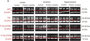 Tau (D1M9X) XP® Rabbit mAb | Cell Signaling Technology