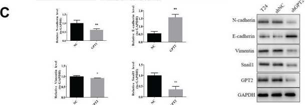 Fig.6.C showing Western Blotting from the publication: Comprehensive Bioinformatics Analysis and Validation of the Mechanism of Glutamic-pyruvic Transaminase 2 in Bladder Cancer.