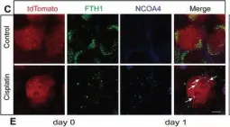 Fig.4.C showing Immunocytochemistry-immunofluorescence from the publication: FOXO1-NCOA4 Axis Contributes to Cisplatin-Induced Cochlea Spiral Ganglion Neuron Ferroptosis via Ferritinophagy.