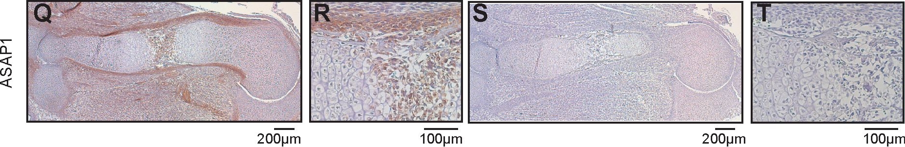 Fig.4.Q,R,S,T showing Immunohistochemistry in a Mus musculus (House mouse) sample from the publication: Loss of ASAP1 in mice impairs adipogenic and osteogenic differentiation of mesenchymal progenitor cells through dysregulation of FAK/Src and AKT signaling.
