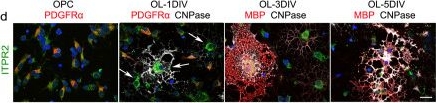 Fig.9.D showing Immunohistochemistry-immunofluorescence from the publication: Ten-eleven translocation 1 mediated-DNA hydroxymethylation is required for myelination and remyelination in the mouse brain.