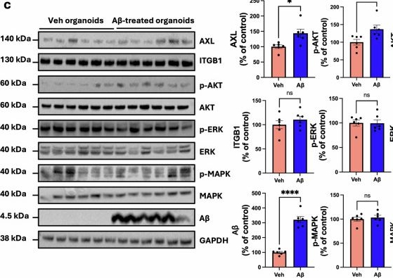 Fig.5.C showing Western Blotting in a Homo sapiens (Human) sample from the publication: Human brain and organoid transcriptomes reveal key receptor tyrosine kinase pathways and genetic signatures in Alzheimer's disease.