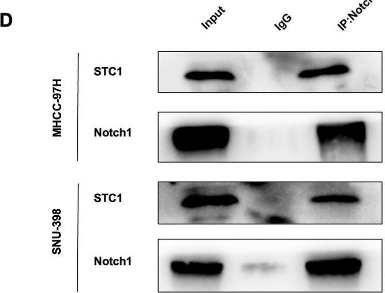 Fig.4.D showing Western Blotting in a Homo sapiens (Human) sample from the publication: The stromal-tumor amplifying STC1-Notch1 feedforward signal promotes the stemness of hepatocellular carcinoma.