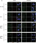 Fig.8.C showing Immunofluorescence in a Homo sapiens (Human) sample from the publication: Raloxifene prevents stress granule dissolution, impairs translational control and promotes cell death during hypoxia in glioblastoma cells.