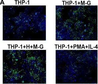 Fig.4.A from the publication: Clonorchis sinensis granulin promotes malignant transformation of human intrahepatic biliary epithelial cells through interaction with M2 macrophages via regulation of STAT3 phosphorylation and the MEK/ERK pathway.