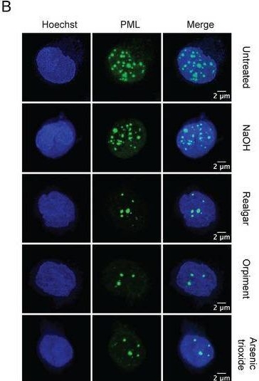 Fig.6.B showing Immunocytochemistry-immunofluorescence in a HIV sample from the publication: Fast pH-Driven Solubilization Method of Realgar (As4S4) to Reduce the Toxicity of Arsenic [As(III)] for Medicinal Purposes.