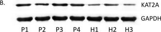 Fig.3.B showing Western Blotting from the publication: A preliminary study of KAT2A on cGAS-related immunity in inflammation amplification of systemic lupus erythematosus.