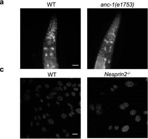 Fig.1.A showing Immunocytochemistry-immunofluorescence from the publication: Nucleophagy delays aging and preserves germline immortality.