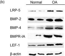 Fig.2.B showing Western Blotting from the publication: Bone morphogenetic protein-2-induced Wnt/β-catenin signaling pathway activation through enhanced low-density-lipoprotein receptor-related protein 5 catabolic activity contributes to hypertrophy in osteoarthritic chondrocytes.