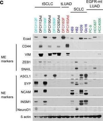 Fig.3.C showing Western Blotting from the publication: EGFR-mutant transformed small cell lung cancer harbors intratumoral heterogeneity targetable with MEK inhibitor combination therapy.